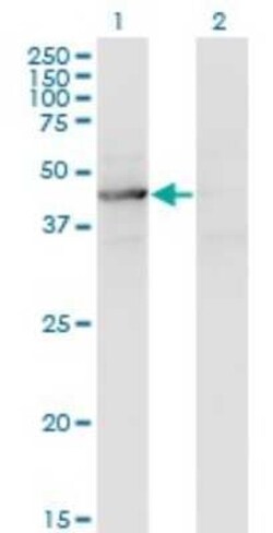 TEX28 Antibody (1A8), Novus Biologicals 0.1 mg | Buy Online | Novus Biologicals | Fisher Scientific