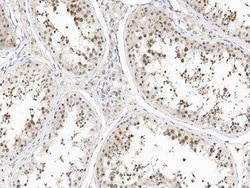 TEX30 Rabbit anti-Human, Polyclonal, Novus Biologicals:Antibodies:Primary