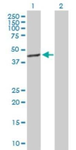 TFB1M Antibody, Novus Biologicals 0.1 mg | Buy Online | Novus Biologicals | Fisher Scientific