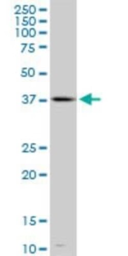 TFDP3 Antibody (3F11), Novus Biologicals 0.1 mg | Buy Online | Novus Biologicals | Fisher Scientific