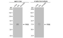 TFEB Antibody (HL1065), Novus Biologicals 100 &mu;g | Buy Online | Novus Biologicals | Fisher Scientific