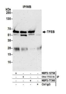 TFEB Antibody (BLR070G), Novus Biologicals 100 &mu;g, Unconjugated:Antibodies,