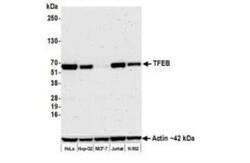 TFEB Antibody (BLR070G), Novus Biologicals 100 &mu;g, Unconjugated:Antibodies,