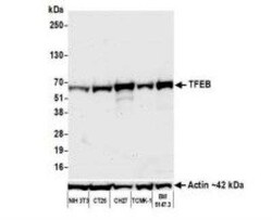TFEB Antibody (BLR070G), Novus Biologicals 100 &mu;g, Unconjugated:Antibodies,