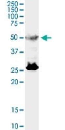 TFEB Antibody (S1), Novus Biologicals 0.1 mg | Buy Online | Novus Biologicals | Fisher Scientific