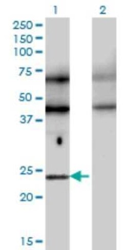 TFEC Antibody (4F11), Novus Biologicals 0.1 mg | Buy Online | Novus Biologicals | Fisher Scientific