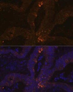 TFF1/pS2 Rabbit anti-Human, Clone: 6P6R7, Novus Biologicals 20 &mu;g | Buy Online | Novus Biologicals | Fisher Scientific