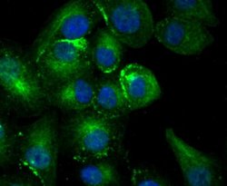 TFF1/pS2 Antibody (JM37-86), Novus Biologicals 100 &mu;l; Unconjugated:Antibodies,