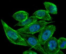 TFF1/pS2 Antibody (JM37-86), Novus Biologicals 100 &mu;l; Unconjugated:Antibodies,