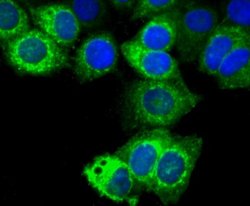 TFF1/pS2 Antibody (JM37-86), Novus Biologicals 100 &mu;l; Unconjugated:Antibodies,