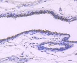 TFF1/pS2 Antibody (JM37-86), Novus Biologicals 100 &mu;l; Unconjugated:Antibodies,