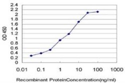 TFF3 Antibody (3D9), Novus Biologicals 0.1 mg | Buy Online | Novus Biologicals | Fisher Scientific