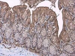TFF3 Antibody, Novus Biologicals 100 μg; Unconjugated:Antibodies, Polyclonal