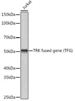 TFG Rabbit anti-Human, Mouse, Rat, Clone: 0V5P10, Novus Biologicals 100 &mu;g | Buy Online | Novus Biologicals | Fisher Scientific