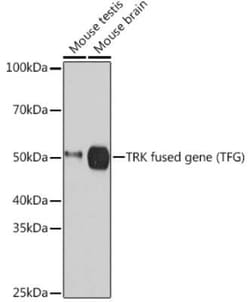 TFG Rabbit anti-Human, Mouse, Rat, Clone: 0V5P10, Novus Biologicals 100 &mu;g | Buy Online | Novus Biologicals | Fisher Scientific
