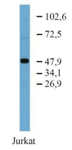 TFG Antibody (TFG-03), Novus Biologicals 0.1 mg | Buy Online | Novus Biologicals | Fisher Scientific