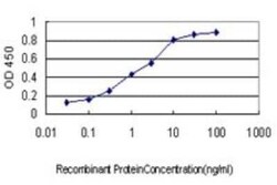TFII-I Antibody (3E2), Novus Biologicals 0.1 mg | Buy Online | Novus Biologicals | Fisher Scientific