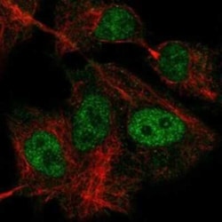 TFIIIC Rabbit anti-Human, Polyclonal, Novus Biologicals 25 &mu;g | Buy Online | Bio-Techne | Fisher Scientific