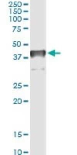 TFIISH Antibody (2C9), Novus Biologicals 0.1 mg | Buy Online | Novus Biologicals | Fisher Scientific