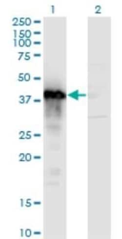 TFIISH Antibody (2C9), Novus Biologicals 0.1 mg | Buy Online | Novus Biologicals | Fisher Scientific