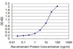 TFIISH Antibody (3B9), Novus Biologicals 0.1 mg | Buy Online | Novus Biologicals | Fisher Scientific