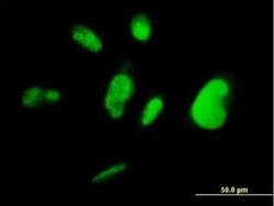 TFIISH Antibody (3B9), Novus Biologicals 0.1 mg | Buy Online | Novus Biologicals | Fisher Scientific
