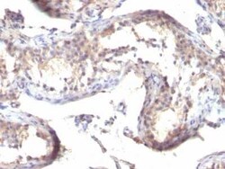TGF-alpha Antibody (TGFA/1119), Novus Biologicals:Antibodies:Primary Antibodies