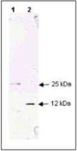 TGF-beta 1 Antibody, Novus Biologicals 0.05 mg; Unconjugated:Antibodies,