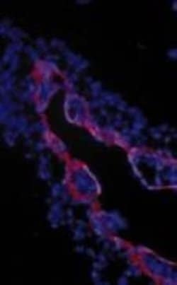 TGF-beta RIII Antibody, Novus Biologicals 250&mu;g:Antibodies, Polyclonal