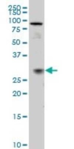 TGF beta induced factor 2 Antibody (5B11), Novus Biologicals 0.1 mg | Buy Online | Novus Biologicals | Fisher Scientific