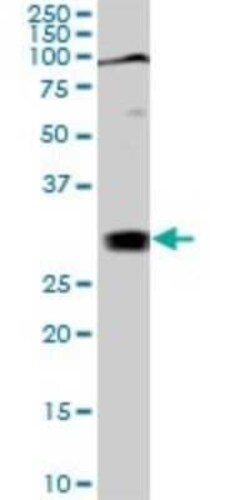 TGF beta induced factor 2 Antibody (5B11), Novus Biologicals 0.1 mg | Buy Online | Novus Biologicals | Fisher Scientific