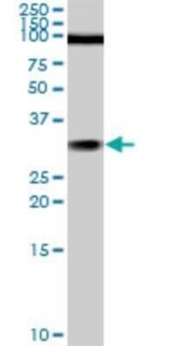 TGF beta induced factor 2 Antibody (5B11), Novus Biologicals 0.1 mg | Buy Online | Novus Biologicals | Fisher Scientific