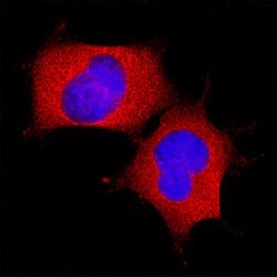 Human LAP (TGF-beta 1) Antibody, R D Systems:Antibodies:Primary Antibodies