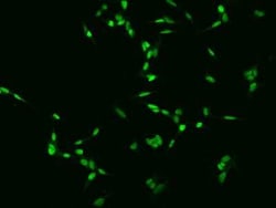 TGIF2LX Antibody, Novus Biologicals 100 &mu;g | Buy Online | Novus Biologicals | Fisher Scientific