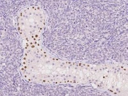 TGIF2LX Antibody, Novus Biologicals 100 &mu;g | Buy Online | Novus Biologicals | Fisher Scientific