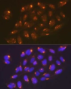 TGN46 Rabbit anti-Human, Clone: 9G5X6, Novus Biologicals:Antibodies:Primary