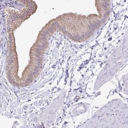TGR5/GPBAR1 Antibody, Novus Biologicals:Antibodies:Primary Antibodies