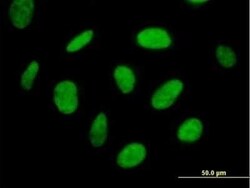 TH1L Antibody, Novus Biologicals 0.05 mg | Buy Online | Novus Biologicals | Fisher Scientific