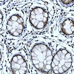TH1L Rabbit anti-Human, Mouse, Rat, Polyclonal, Novus Biologicals 100 &mu;g;
