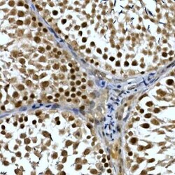 TH1L Rabbit anti-Human, Mouse, Rat, Polyclonal, Novus Biologicals 100 &mu;g;