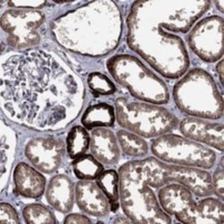 TH1L Rabbit anti-Human, Polyclonal, Novus Biologicals 100 &mu;g | Buy Online | Novus Biologicals | Fisher Scientific