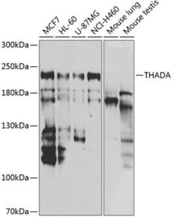 THADA Antibody - BSA Free, Novus Biologicals:Antibodies:Primary Antibodies