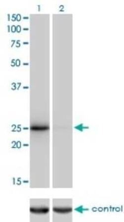 THAP1 Antibody (2C1-2F2), Novus Biologicals 0.1 mg | Buy Online | Novus Biologicals | Fisher Scientific