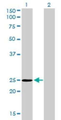 THAP1 Antibody (2C1-2F2), Novus Biologicals 0.1 mg | Buy Online | Novus Biologicals | Fisher Scientific