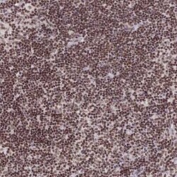 THAP11 Antibody, Novus Biologicals 25 &mu;L | Buy Online | Novus Biologicals | Fisher Scientific