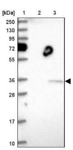THAP11 Antibody, Novus Biologicals 25 &mu;L | Buy Online | Novus Biologicals | Fisher Scientific