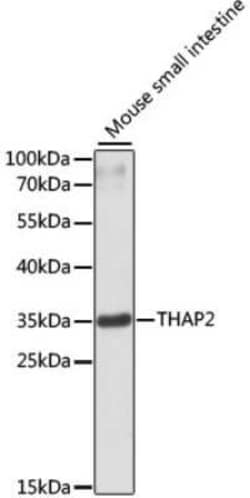 THAP2 Antibody - Azide and BSA Free, Novus Biologicals 0.02 mL; Unconjugated:Antibodies,