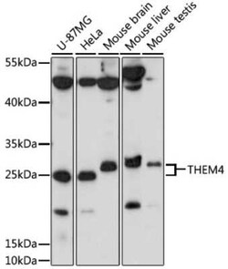 THEM4 Antibody - Azide and BSA Free, Novus Biologicals 0.02 mL; Unconjugated:Antibodies,