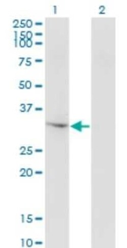 THG1L Antibody (4F11), Novus Biologicals 0.1 mg | Buy Online | Novus Biologicals | Fisher Scientific