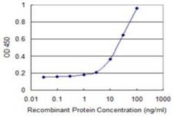 THOC3 Antibody (3D4), Novus Biologicals 0.1 mg; Unconjugated:Anticuerpos